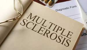 Multiple Sclerosis, MS, Extreme tiredness, Dizzy, Dizziness, Weak, Fog, Sclerosis, demyelinating, myelin